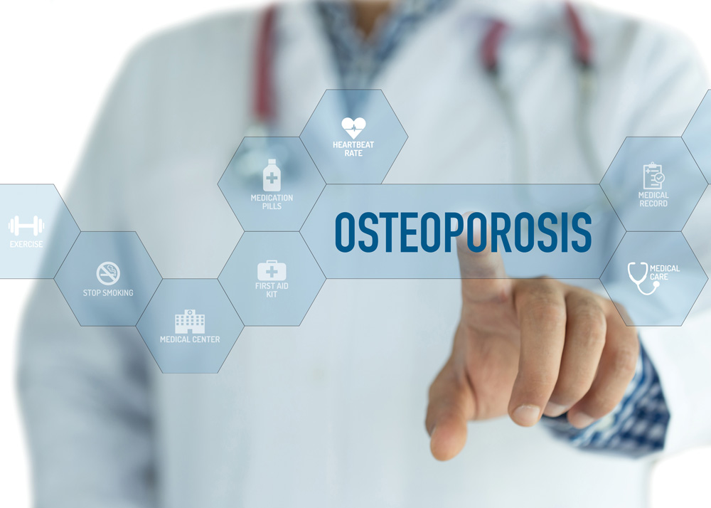 Osteoporose Diagnose in Köln