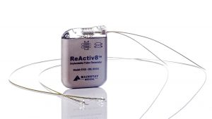 ReActiv8 εμφύτευμα - Καινοτόμο εμφυτεύσιμο σύστημα νευροδιεγέρσεως 