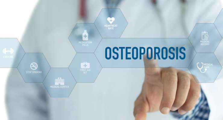 Osteoporose Therapie – Diagnose, Risikofaktoren und Prophylaxe